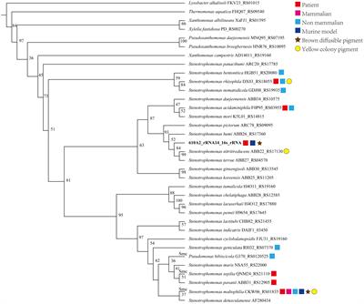 A novel pathogenic species of genus Stenotrophomonas: Stenotrophomonas pigmentata sp. nov